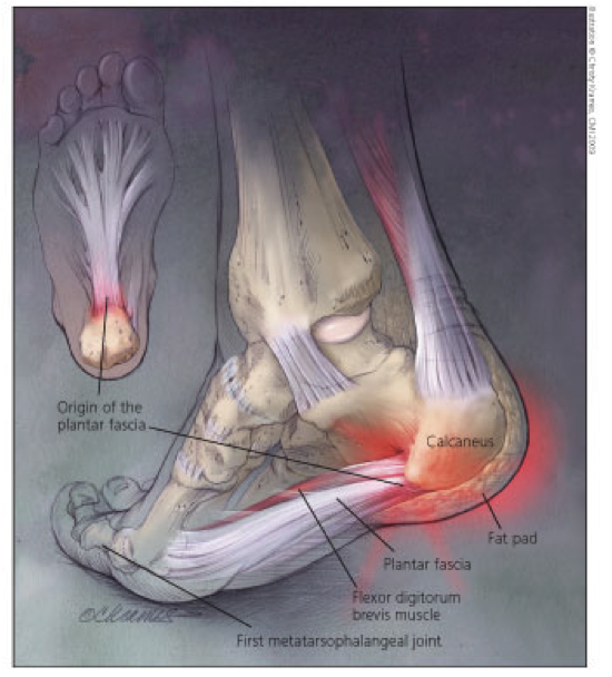 Plantar Fascia Plantar Fascia